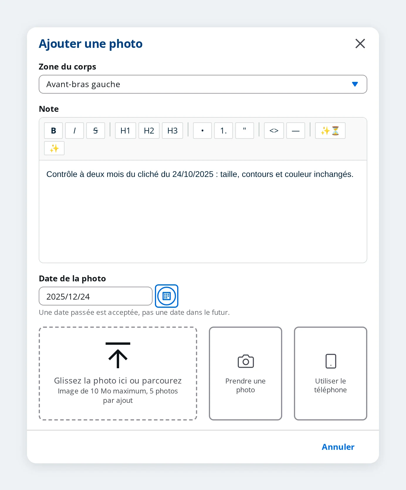 Fenêtre d'ajout d'une photo sur une zone du corps dans DrBook, avec les trois moyens d'envoi