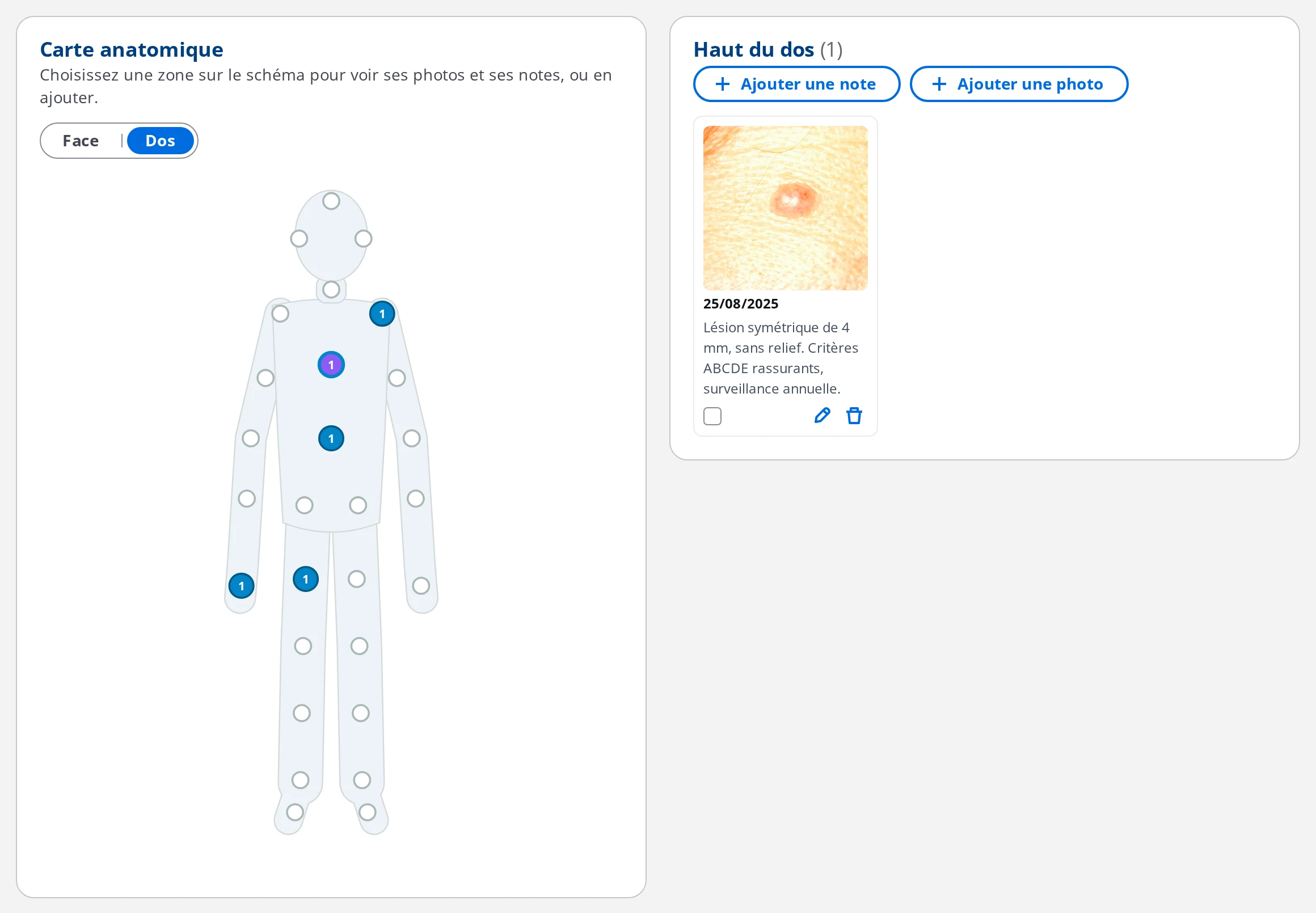 Vue de dos du schéma corporel dans DrBook, avec la zone Haut du dos sélectionnée