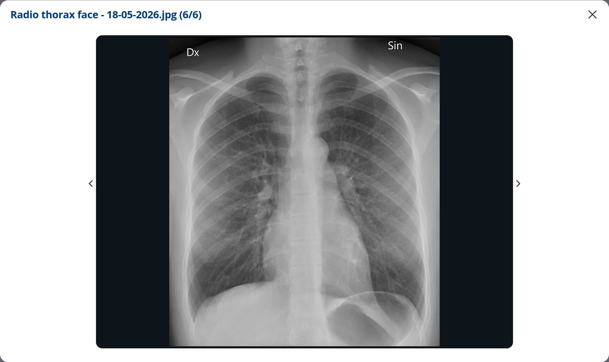 Visionneuse d'images de DrBook affichant une radiographie thoracique de face en plein écran, avec navigation entre les images de la visite
